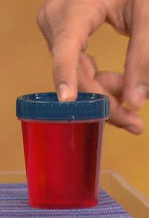 red urine 