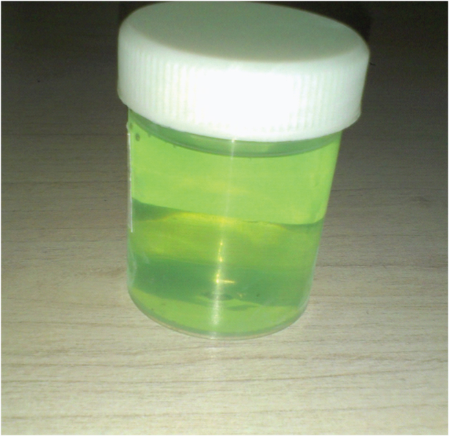 green urine