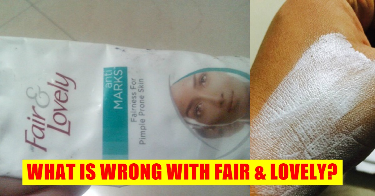 what-s-wrong-with-fairness-creams-like-fair-lovely-know-the-harmful