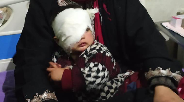 Jammu-Kashmir: 20-month-old girl hit by pellet inside her home, might lose sight