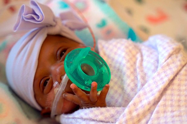 Born at 8.6 ounces, Saybie from San Diego is now the world’s smallest ...