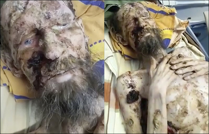 Russian Man Found Inside A Bear’s Cave “Looking Like A Mummy” After