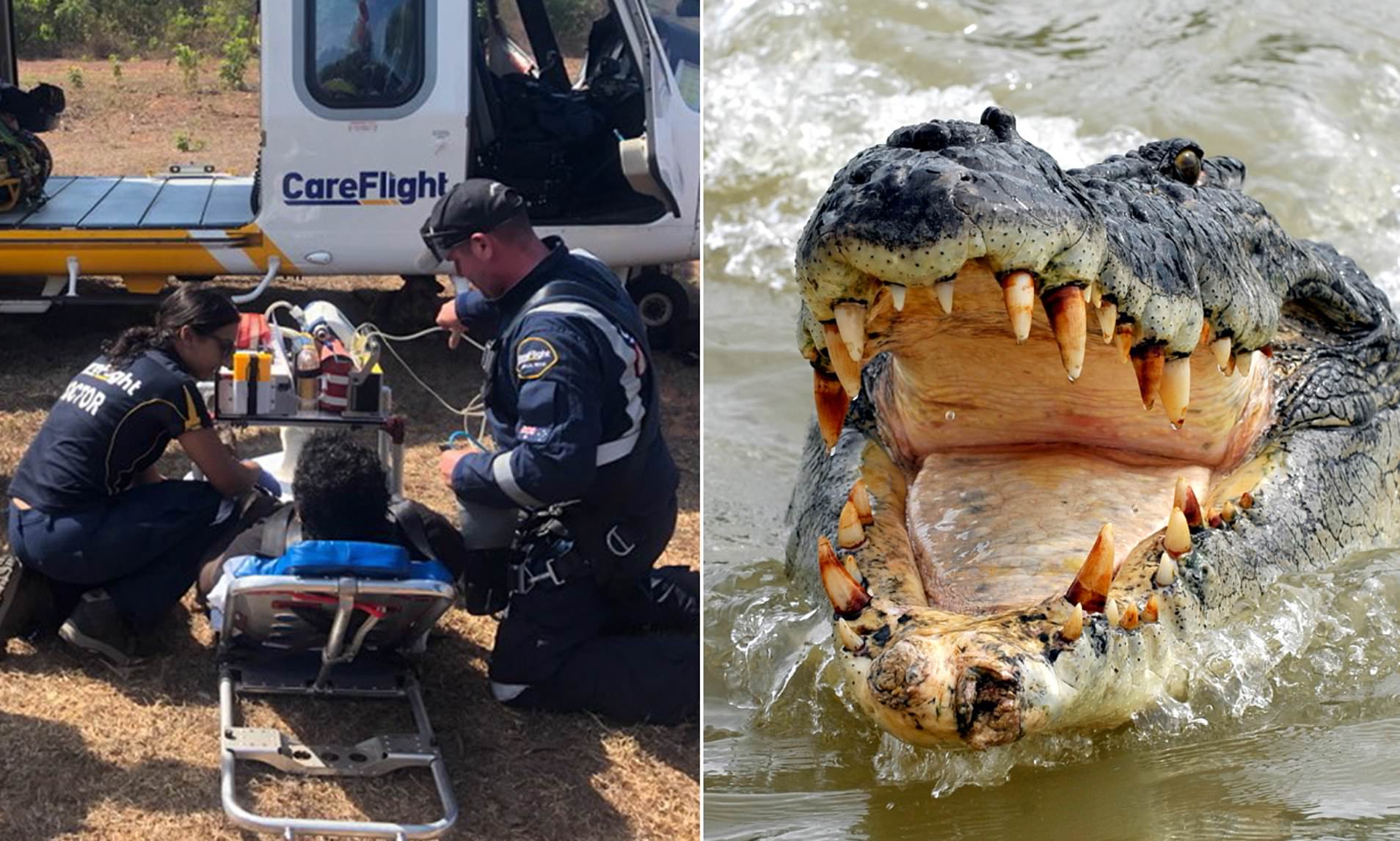 4.5 Meter Crocodile Bites Hunter On The Penis After He Stepped On The