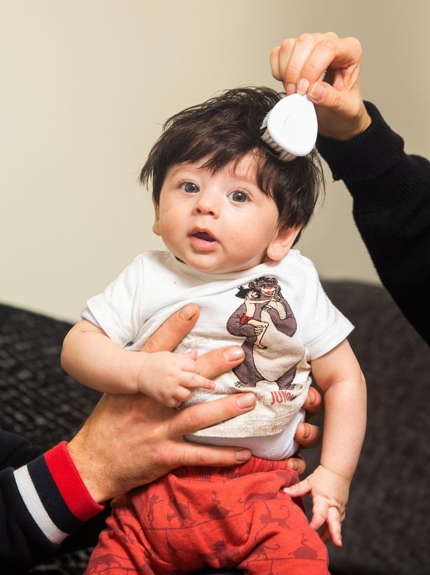 Baby Mowgli? Infant Born With 2 Inches Of Dark Black Hair Looks Amazingly  Adorable