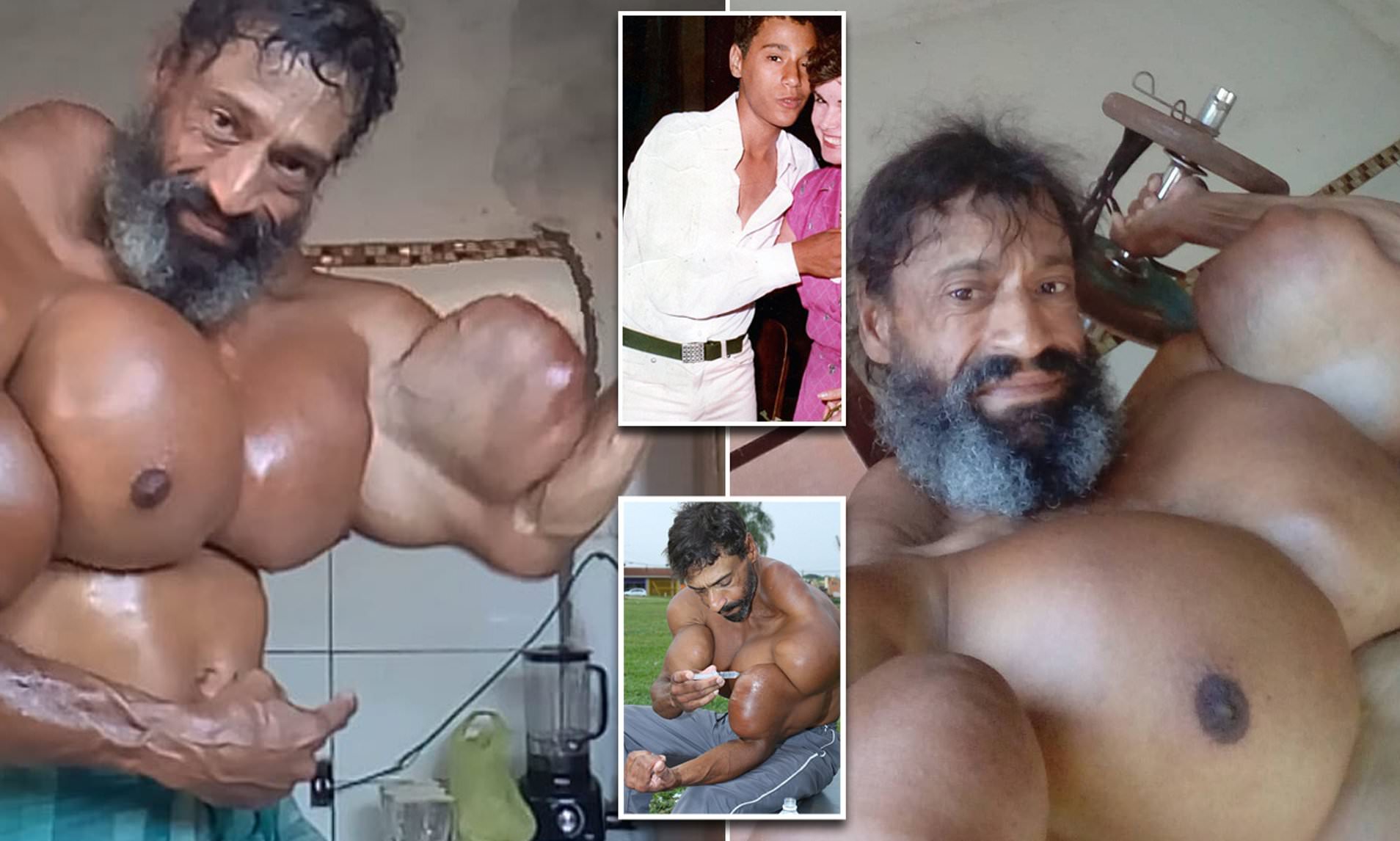 Synthol Porn