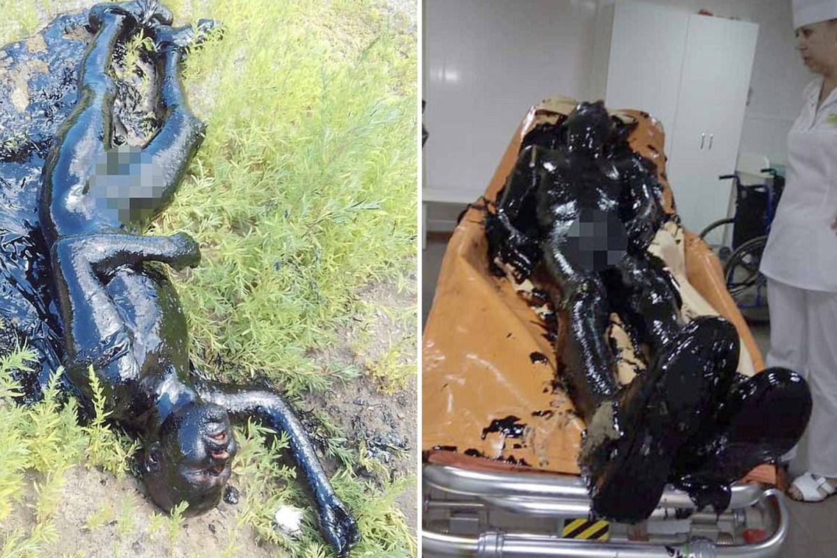33-Year-Old Man Left Covered In Toxic Tar After Falling Into A Pool Of