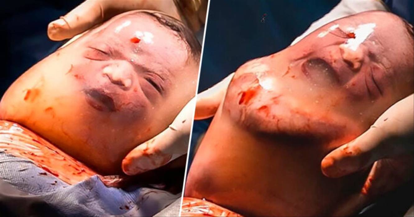 Extremely Rare Photographs Show Newborn Baby Still Inside ...