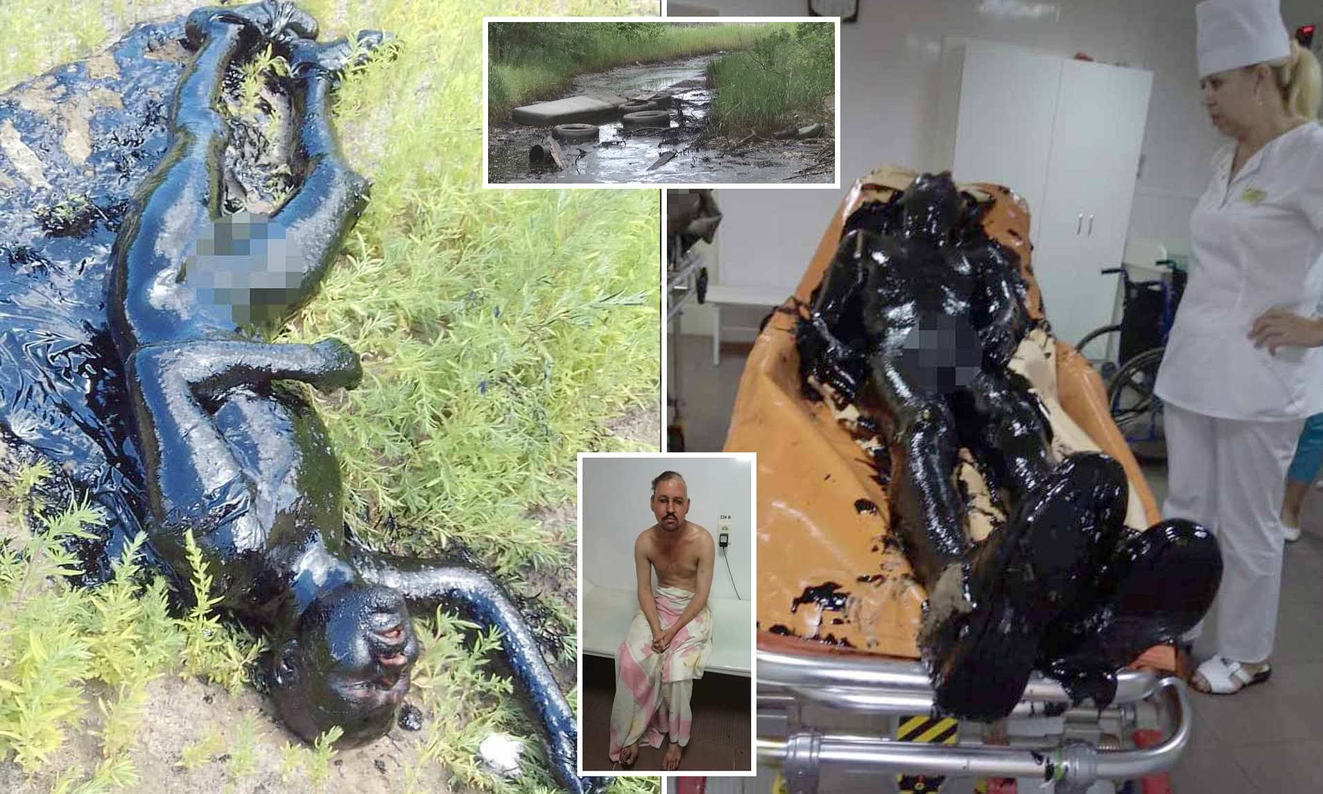 Man Left Covered In Toxic Tar After Falling Into Pit Of