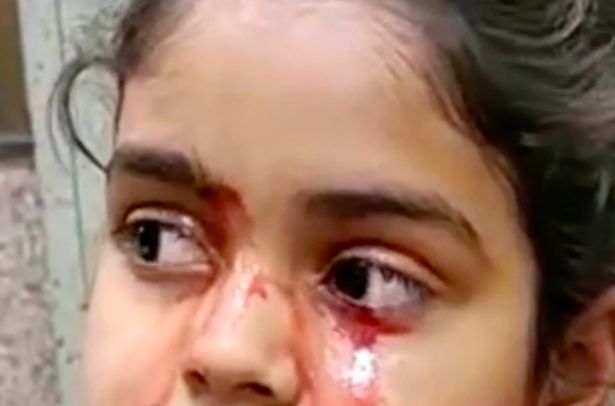 11-Year-Old Indian Girl Has Blood Coming Out Of Her Eyes Every Day Due