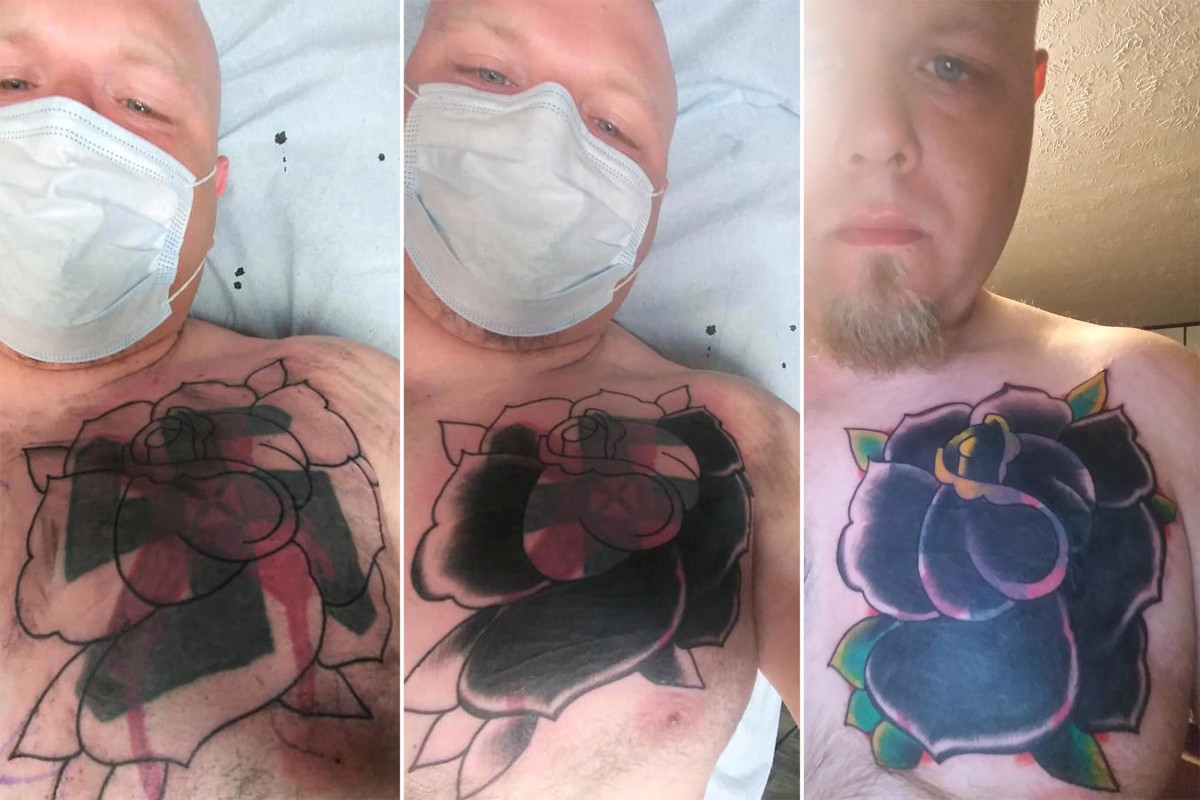 Former White Supremacist Gets Giant Swastika Tattoo Covered Up With