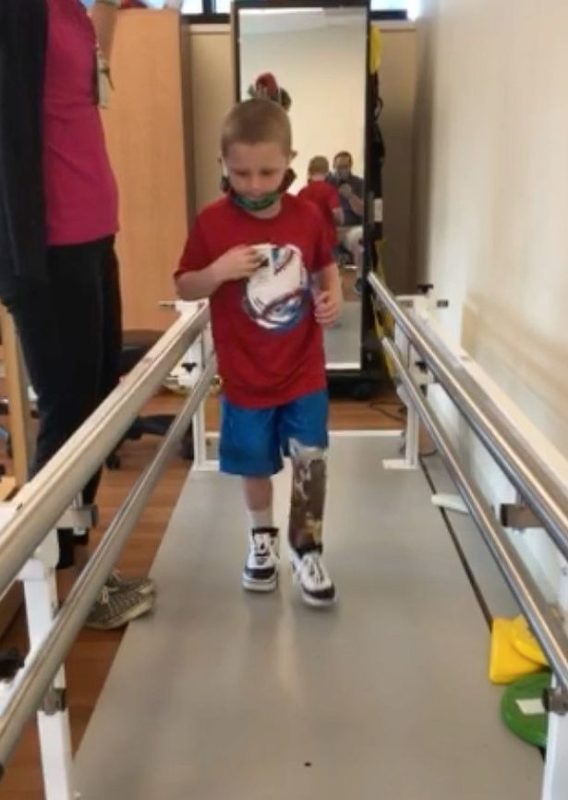 6YearOld Boy Loses Leg After Mother Accidentally Ran Lawnmower Over