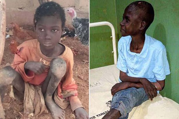 10-Year-Old Boy Found In Emaciated State After Being Tied 