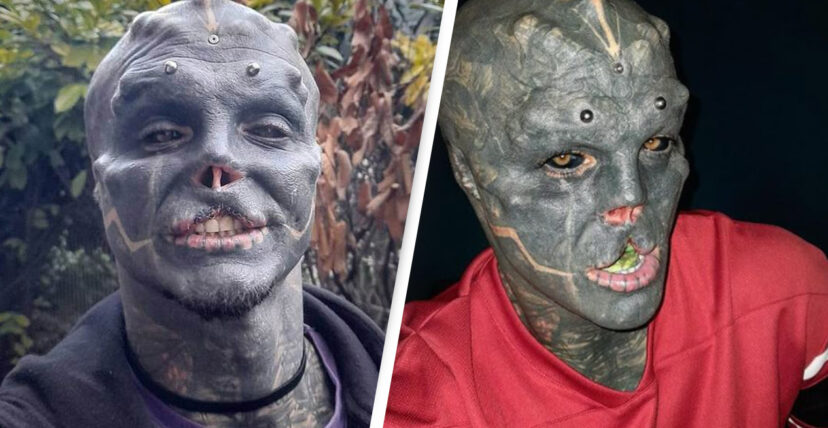 Mutant Man Has Top Lip Removed So He Could Become A “Black Alien”