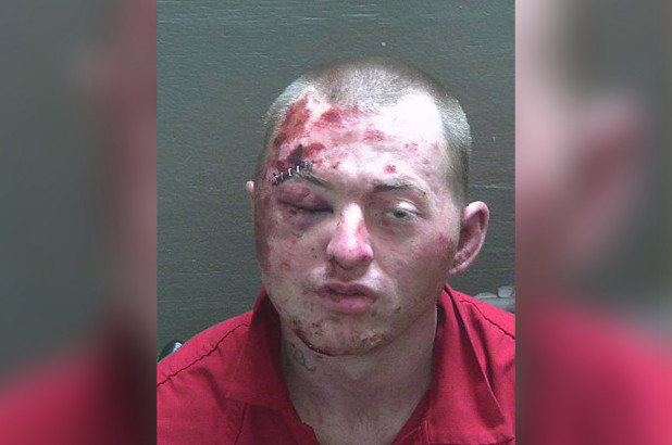 Don’t fight the police: Florida man badly loses fight with cops and K-9